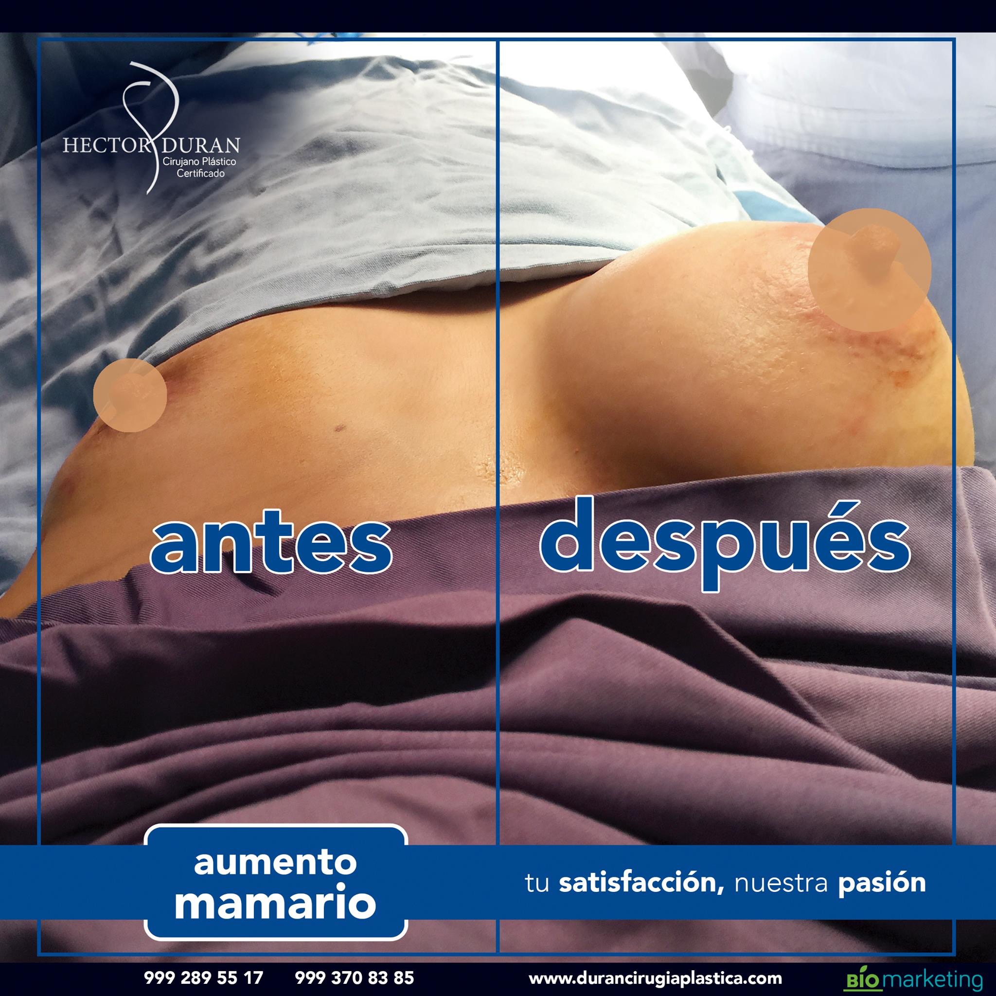 Фотографии "До и После"