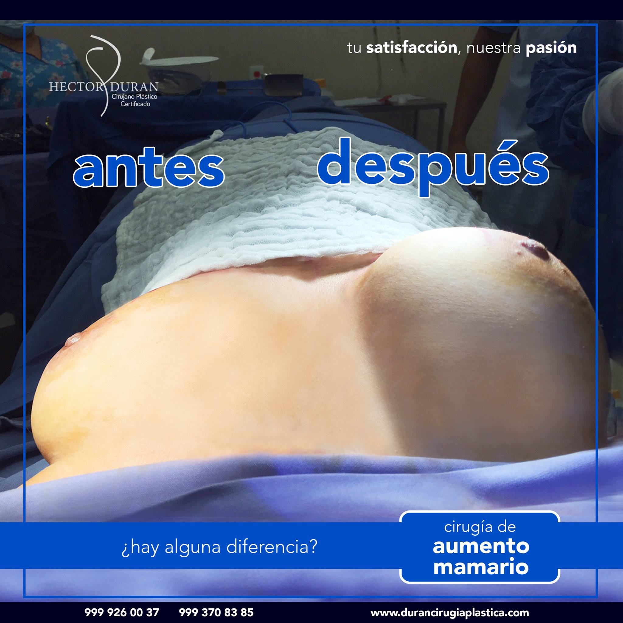 Фотографии "До и После"