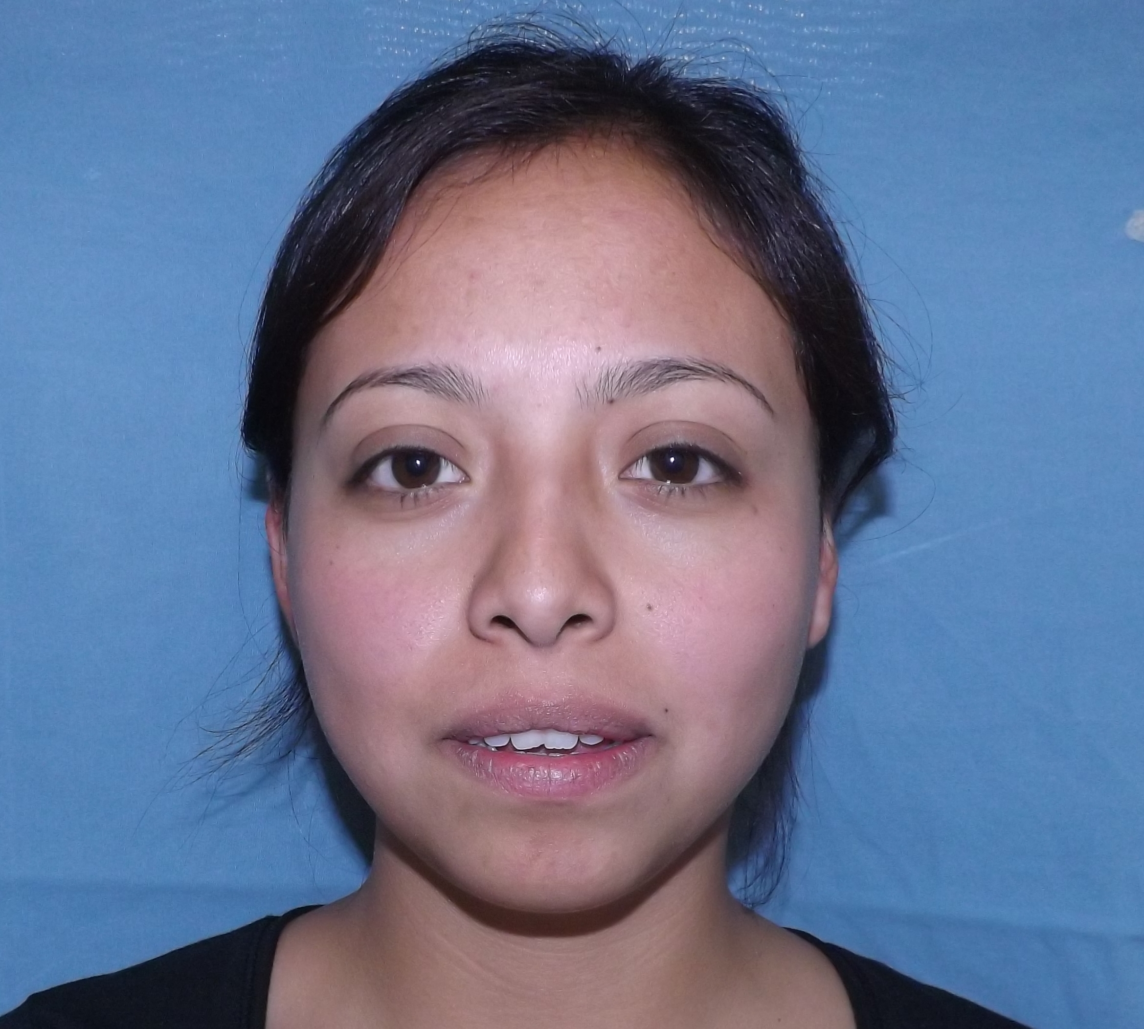 Photos avant et après