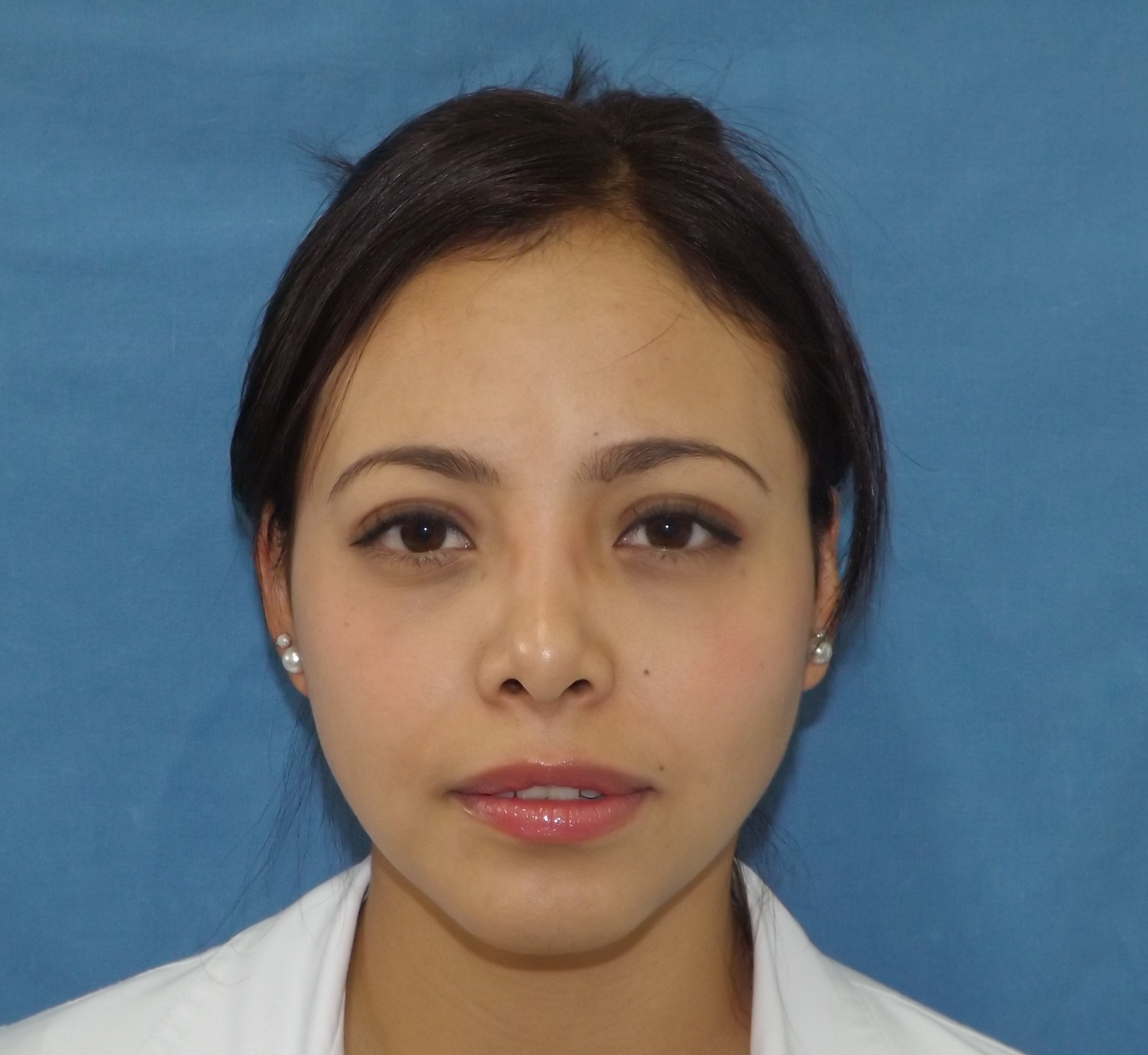 Photos avant et après