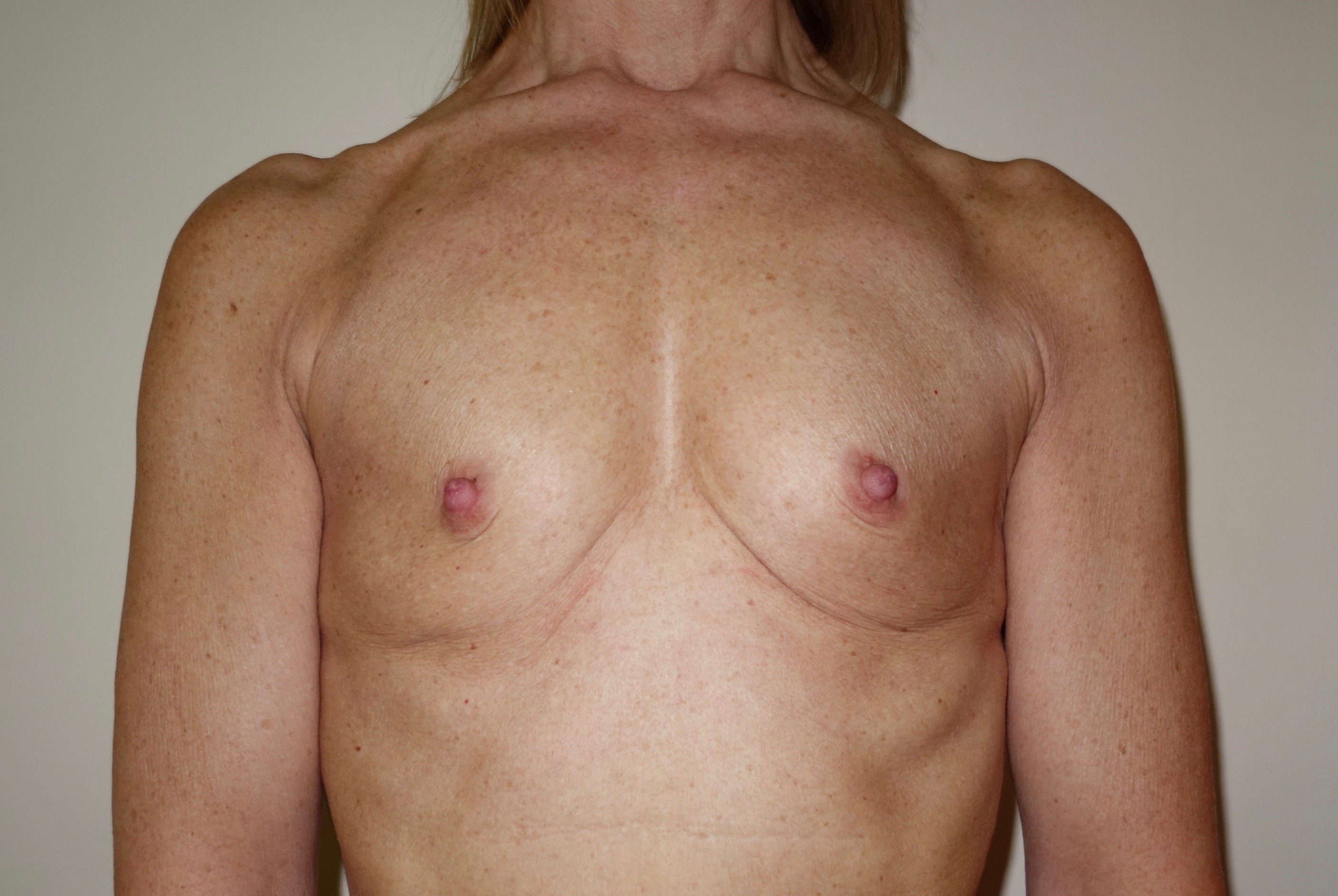 Fotos Antes y Después