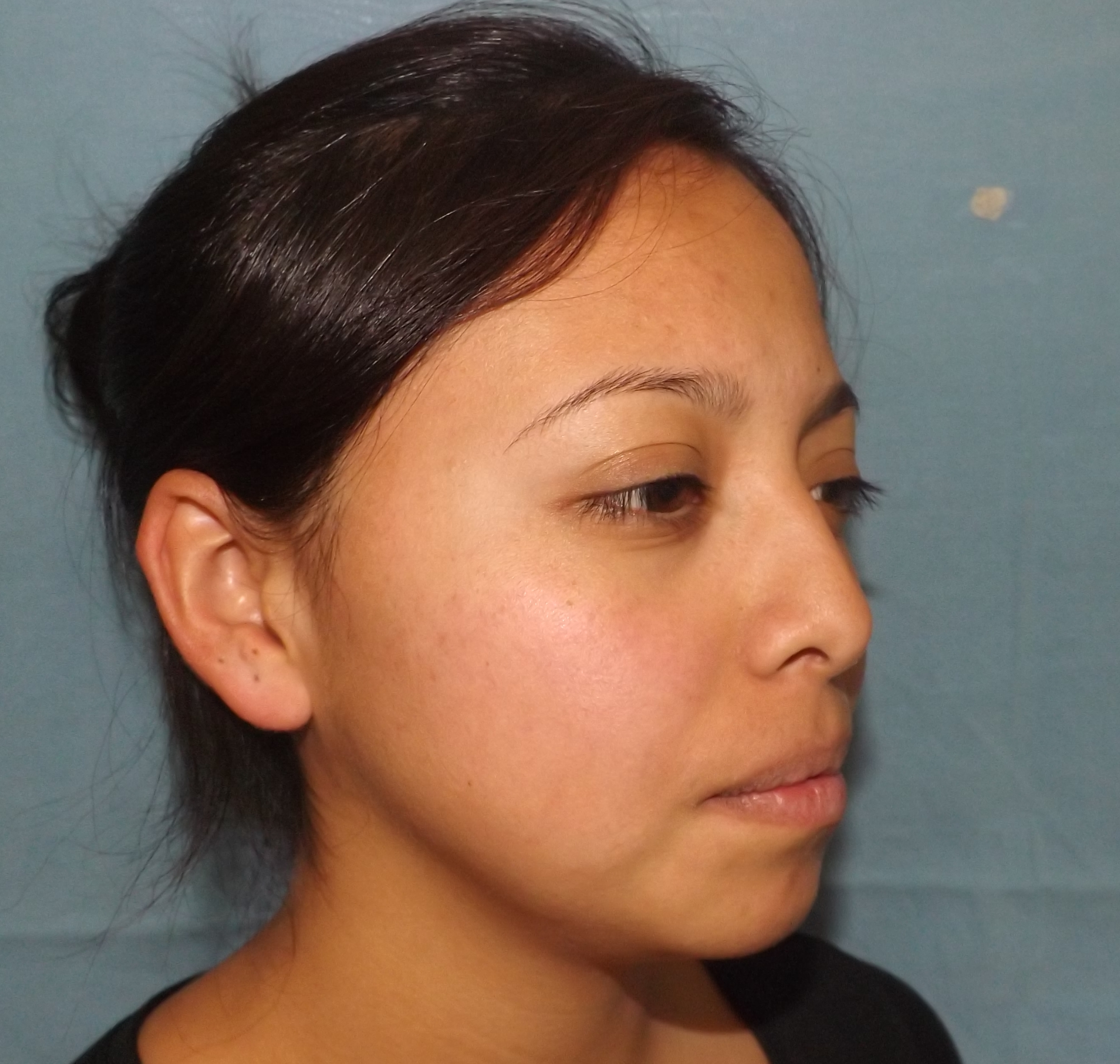 Photos avant et après