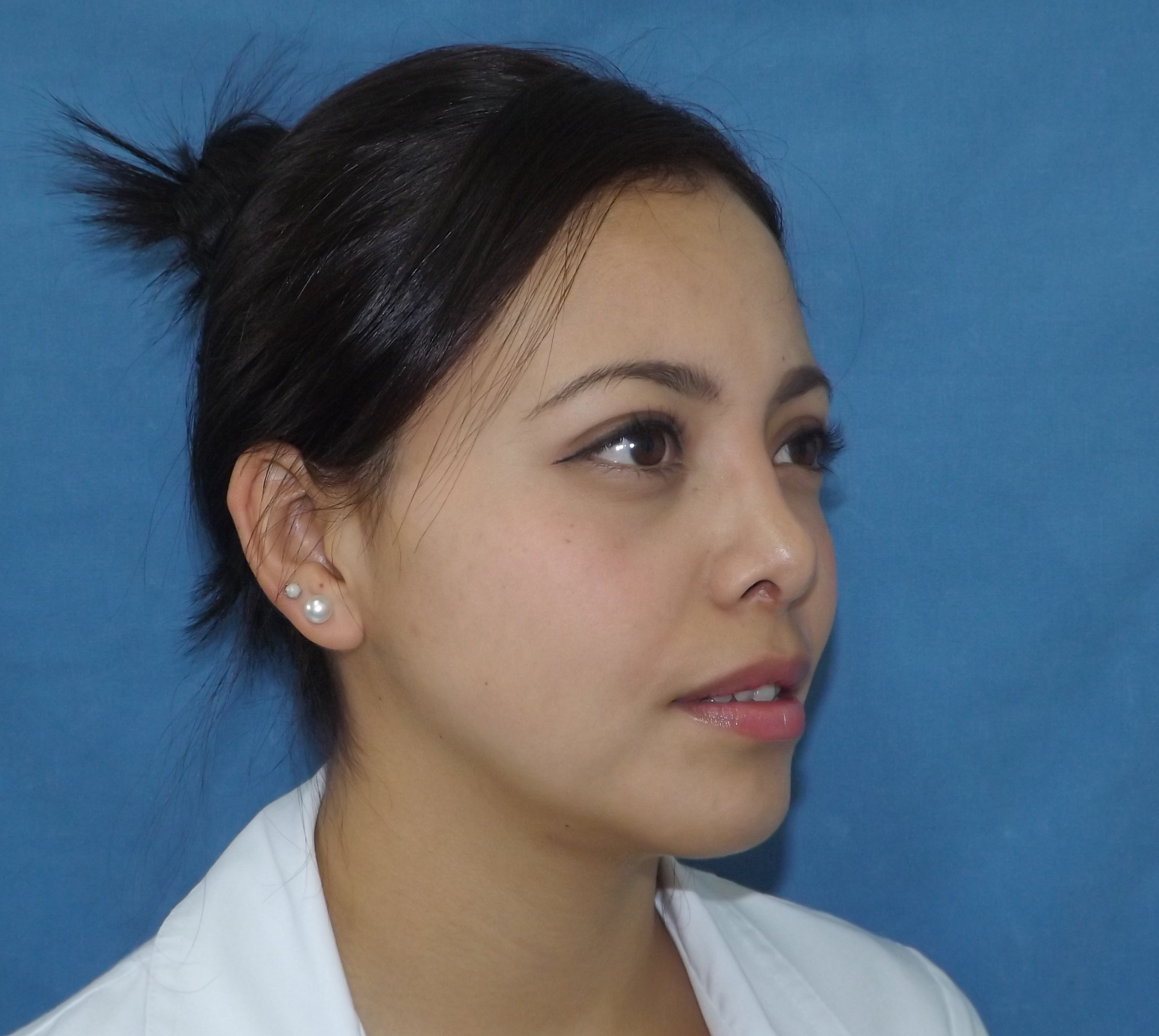 Photos avant et après