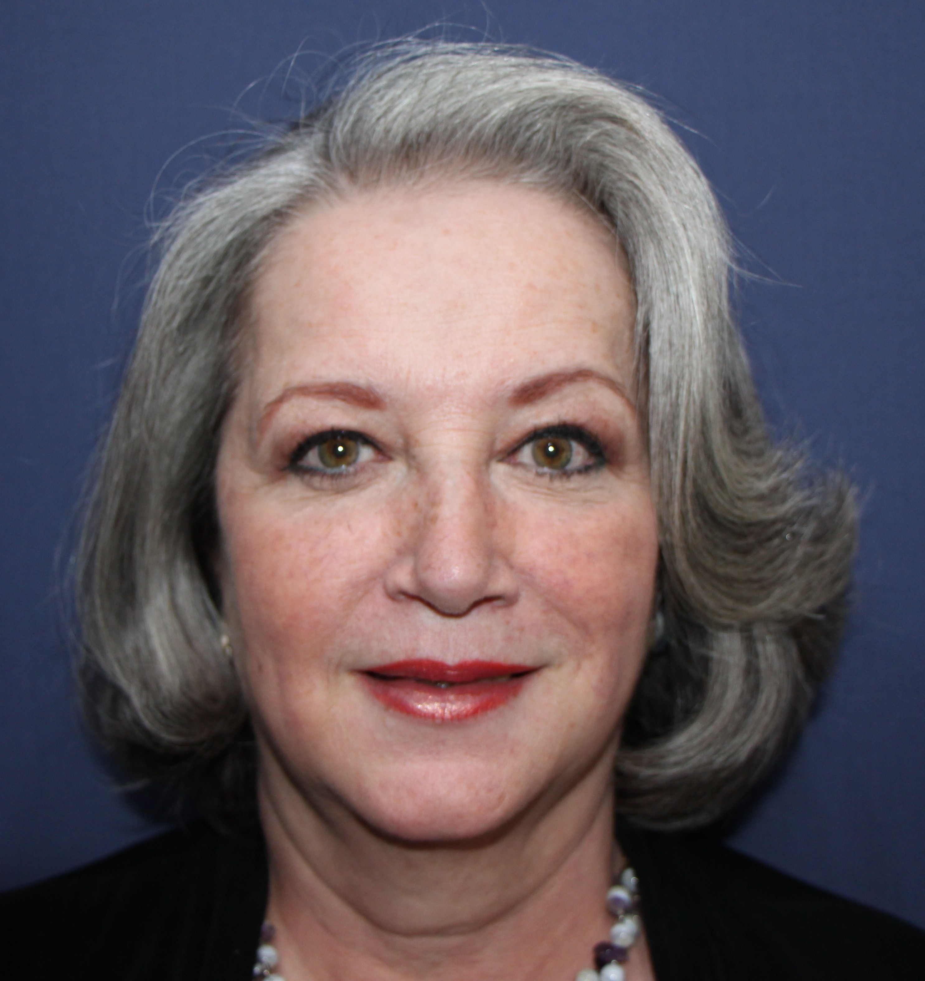 Photos avant et après