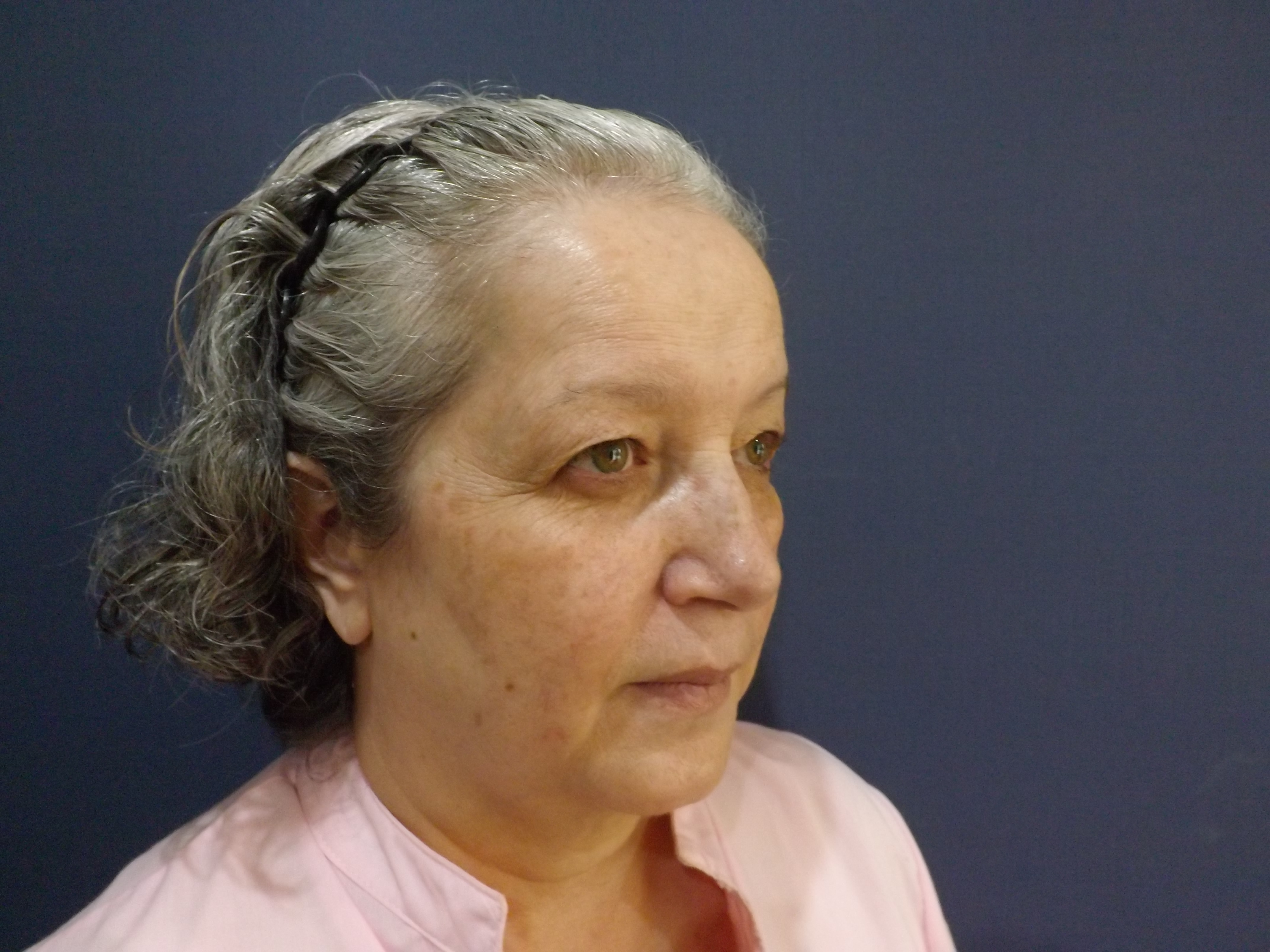 Photos avant et après