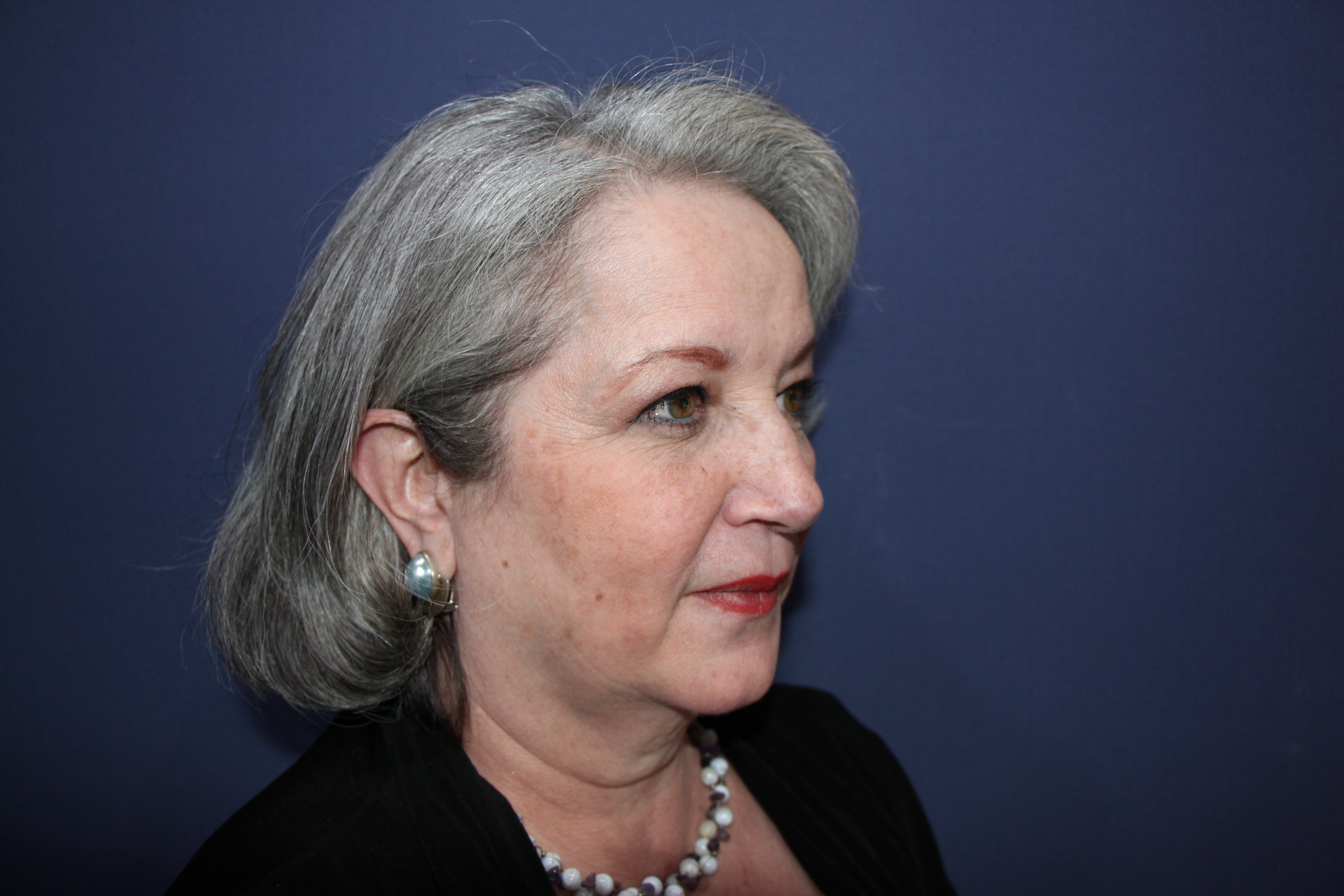 Photos avant et après