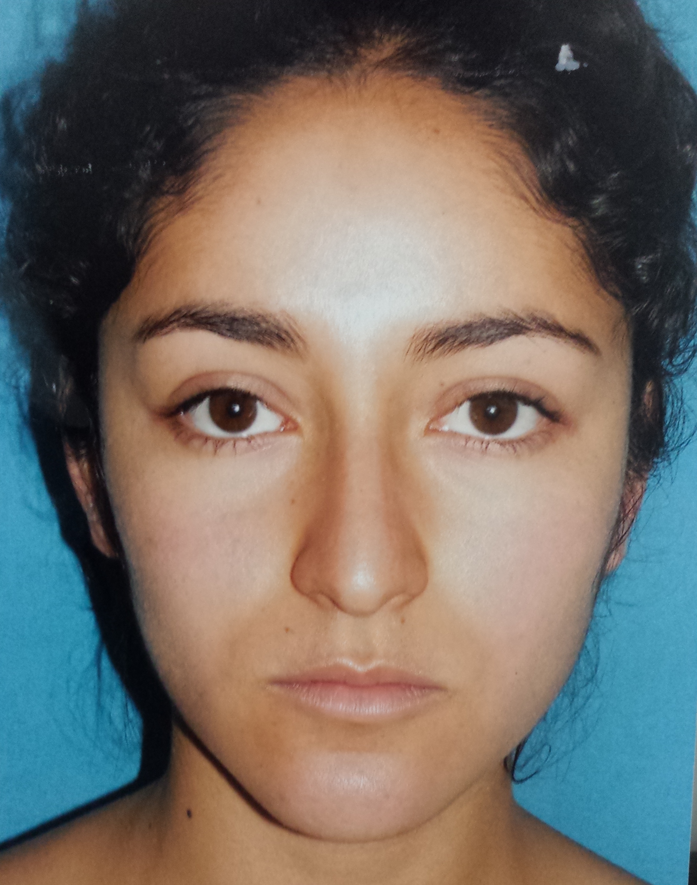 Photos avant et après