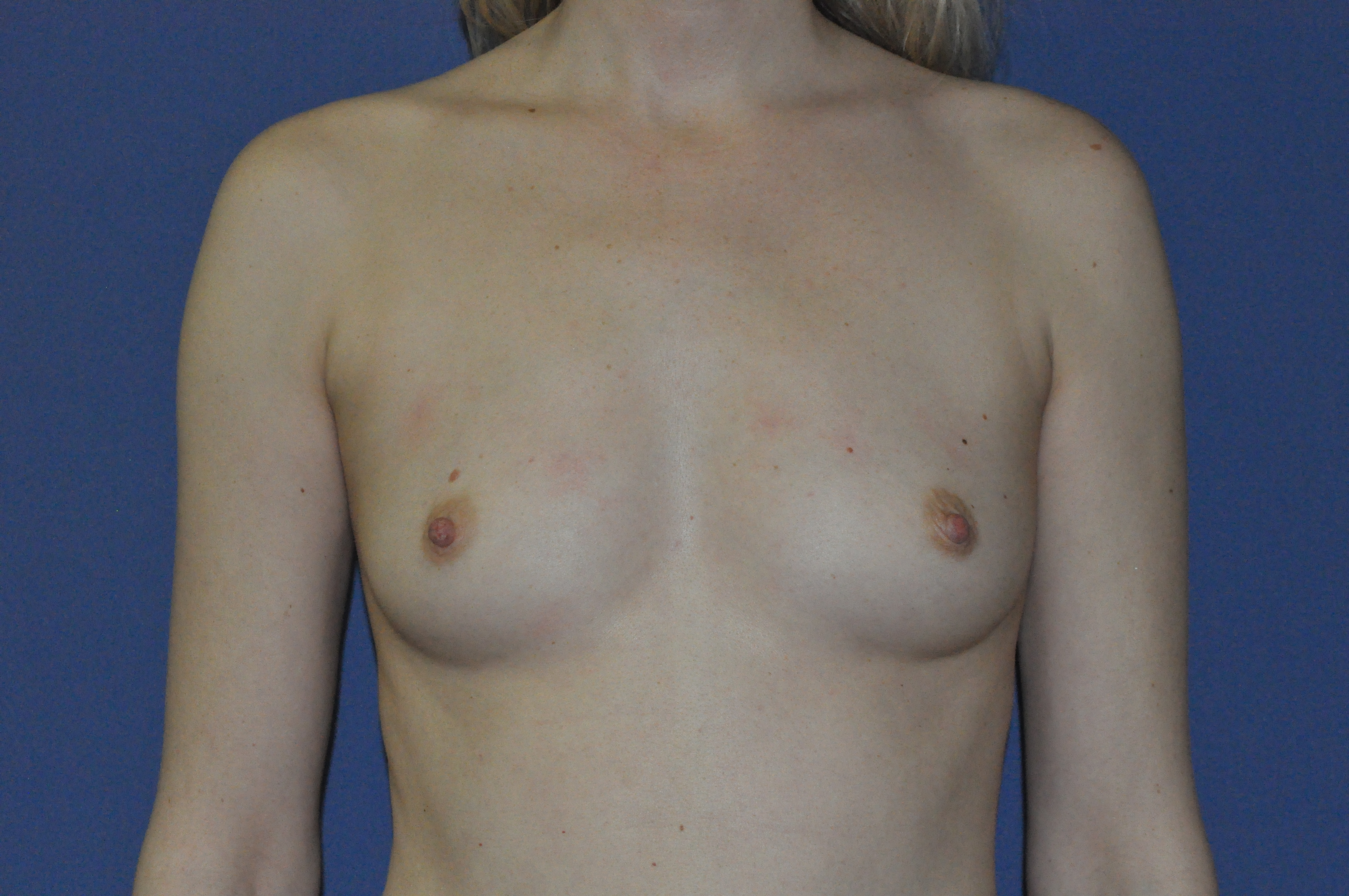 Önce ve sonra resimleri