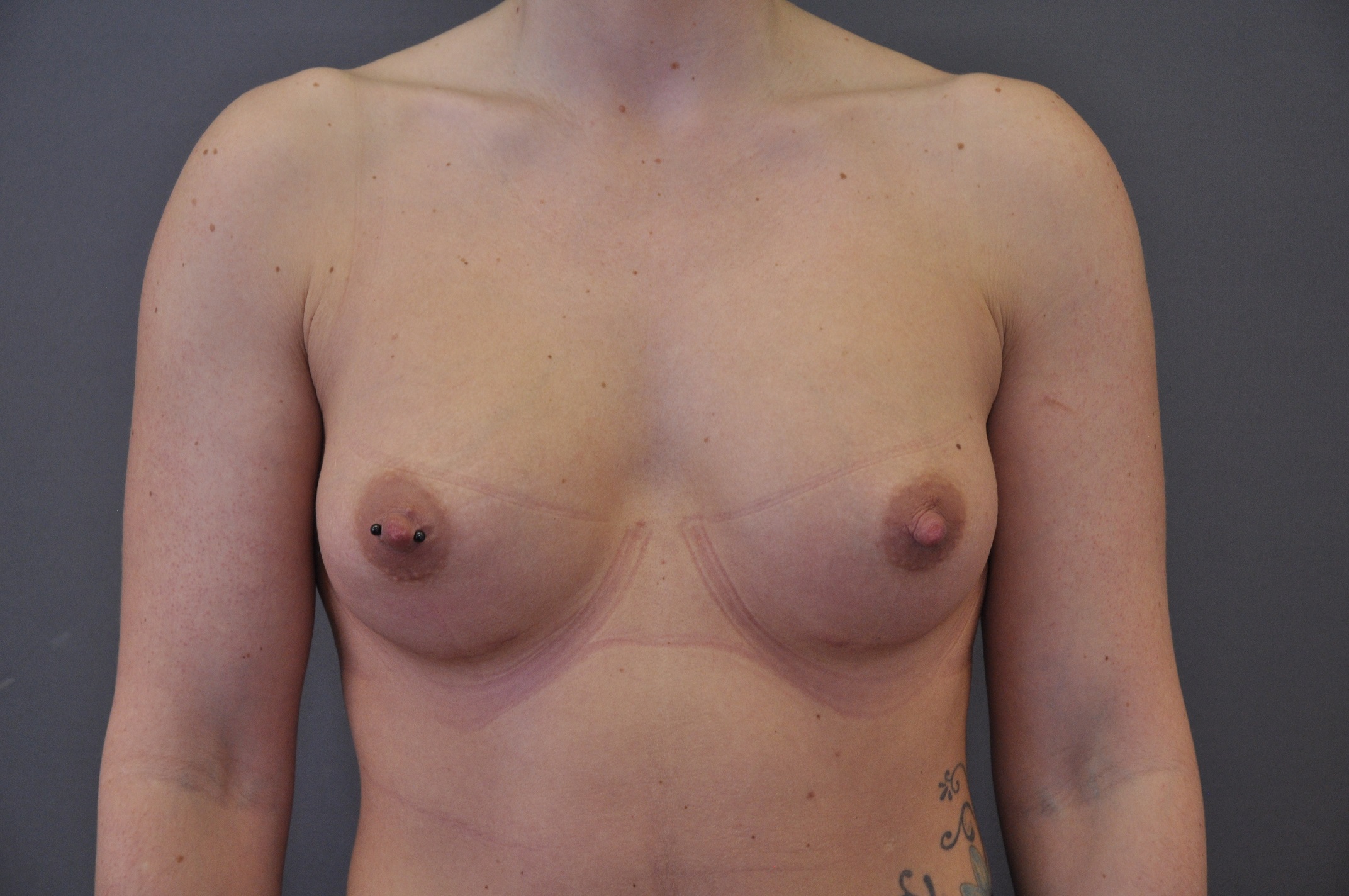 Önce ve sonra resimleri