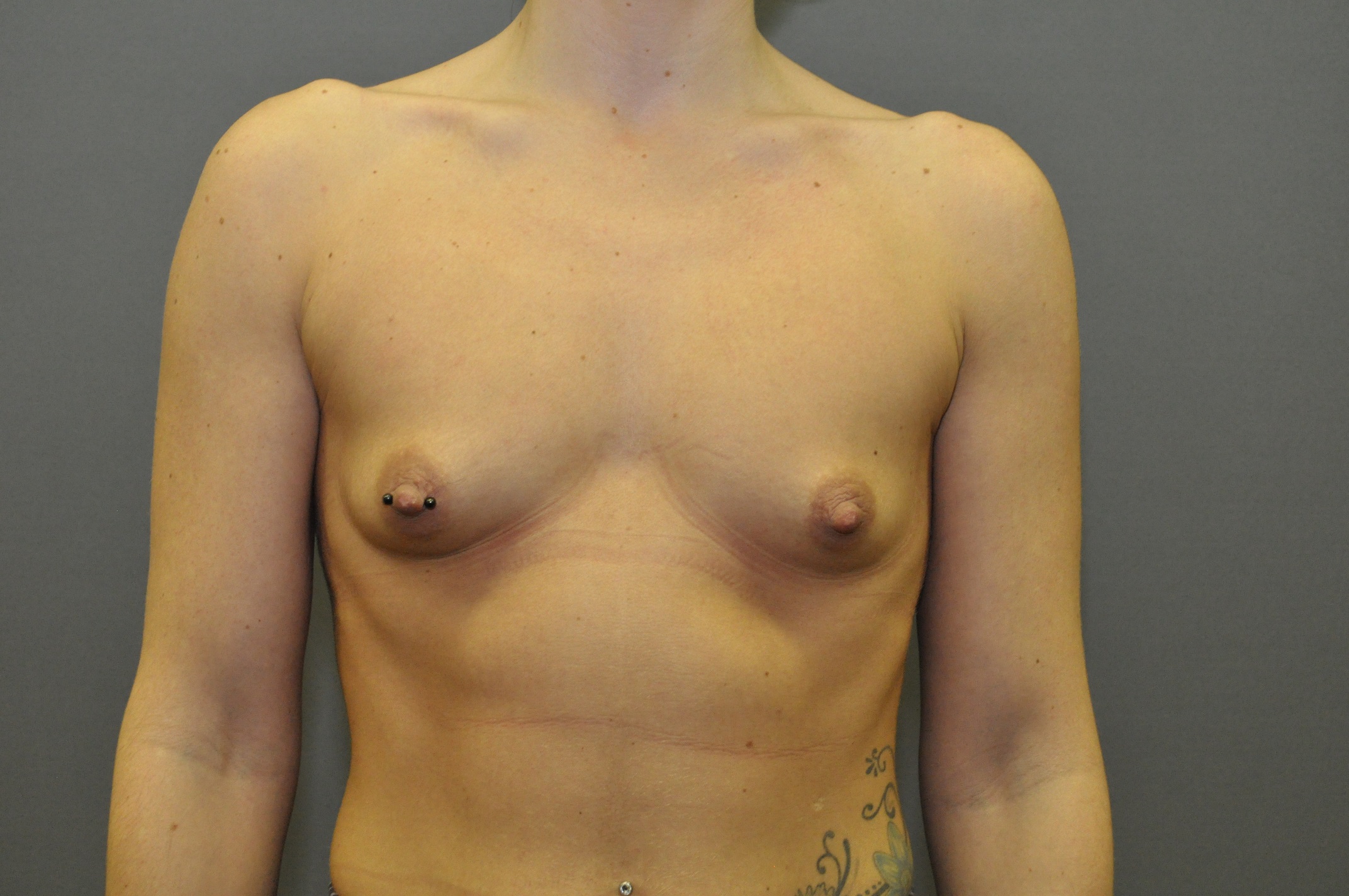 Önce ve sonra resimleri