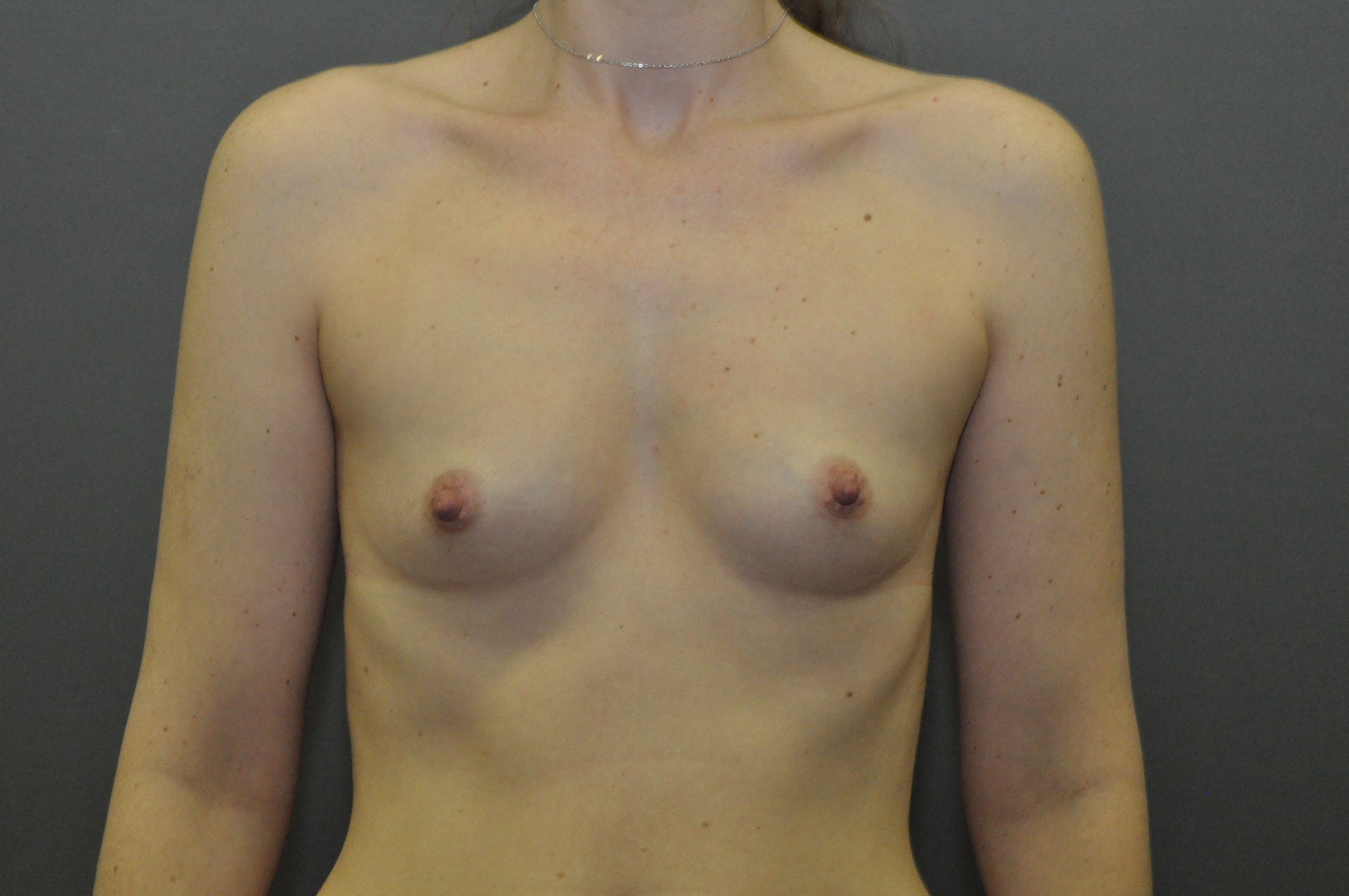 Önce ve sonra resimleri