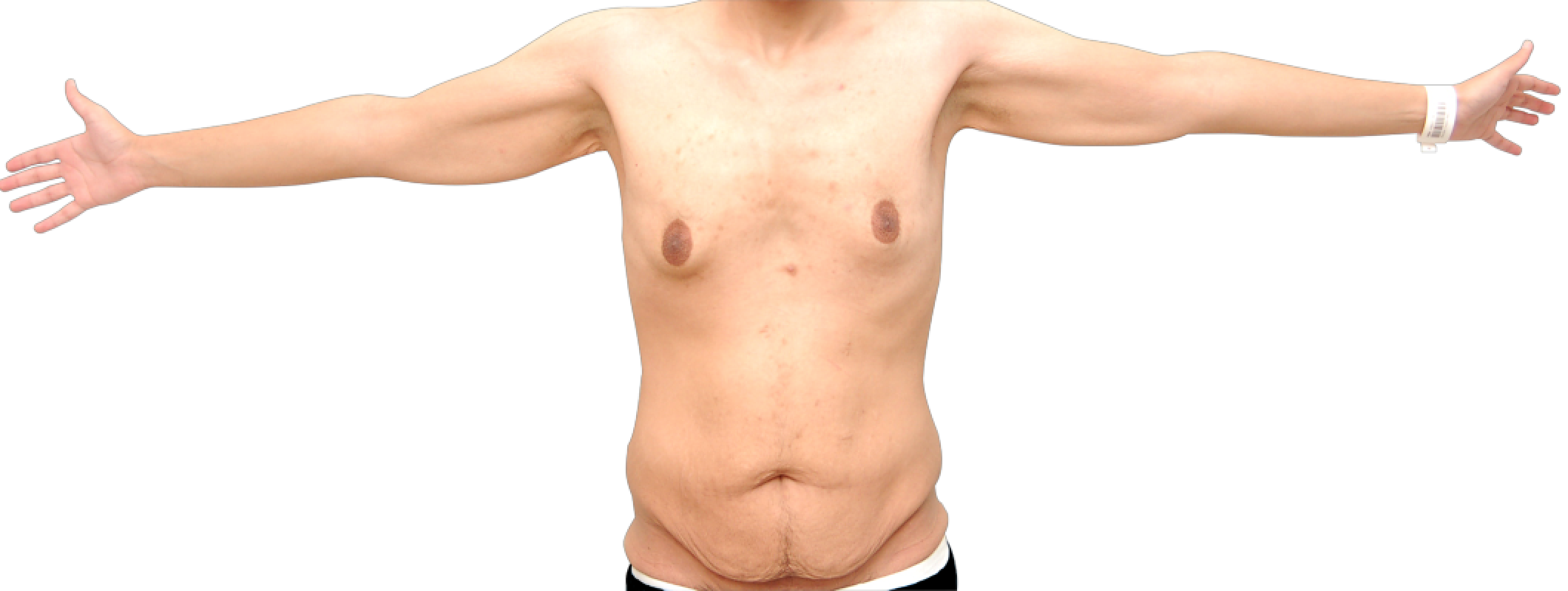 Фотографии "До и После"