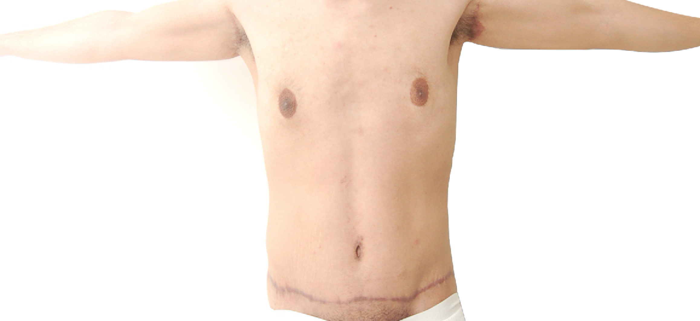 Фотографии "До и После"