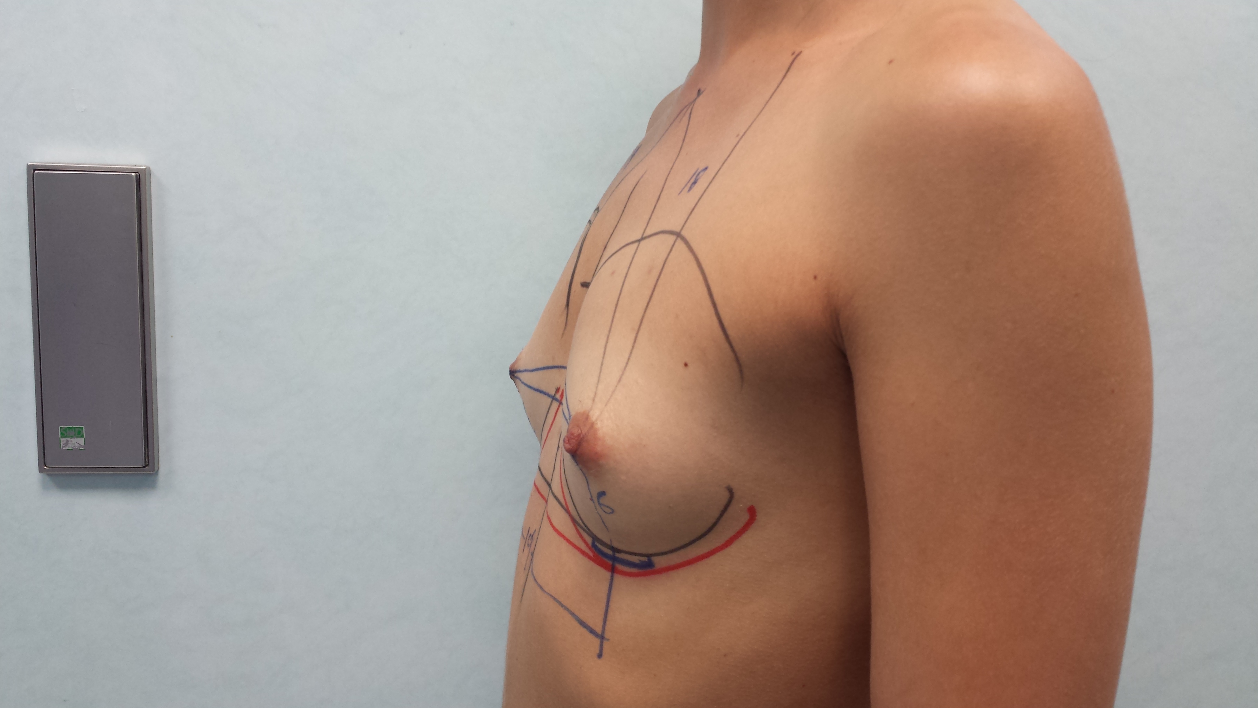 Фотографии "До и После"