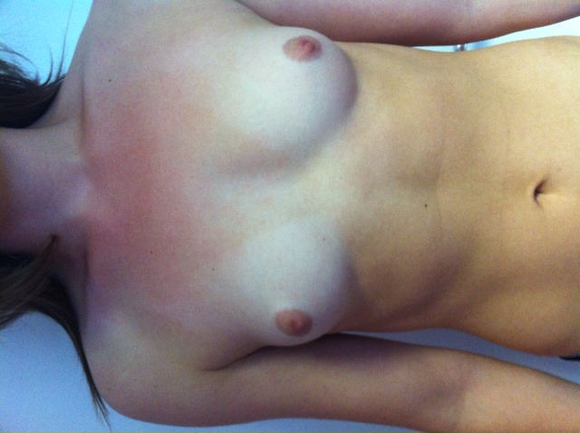 ภาพก่อนและหลัง