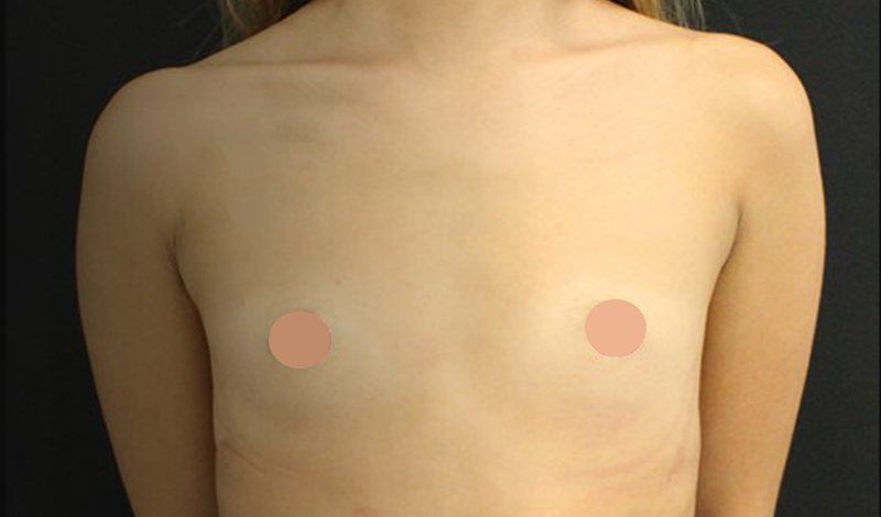 Фотографии "До и После"