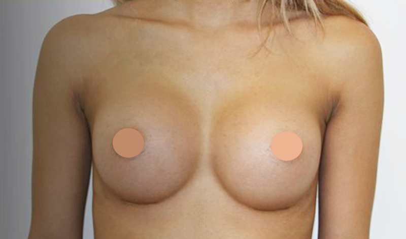 Фотографии "До и После"