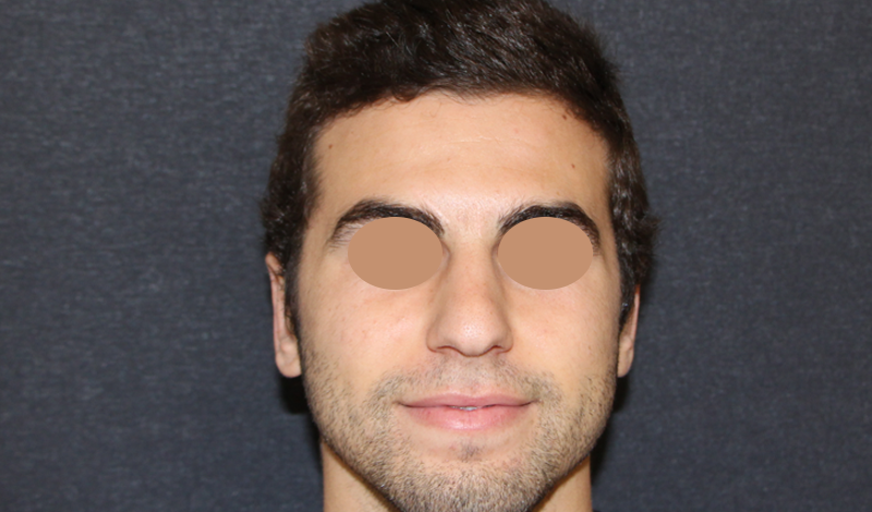 Фотографии "До и После"