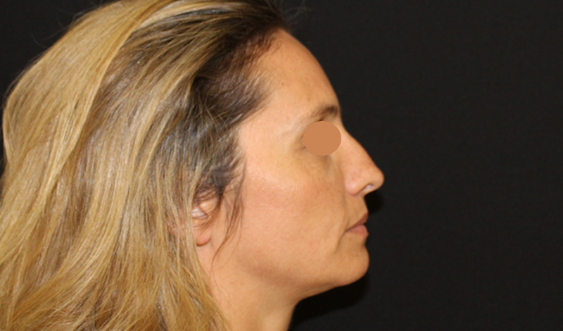 Фотографии "До и После"