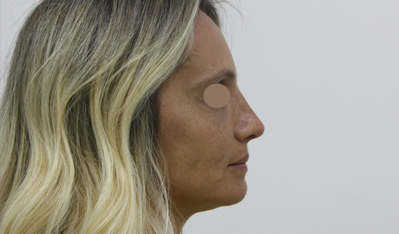 Фотографии "До и После"