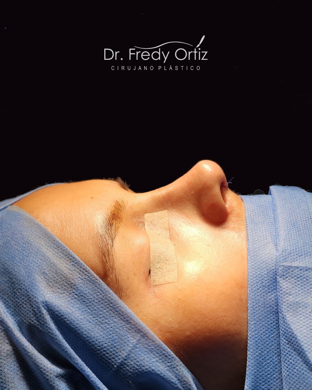 Ảnh trước và sau