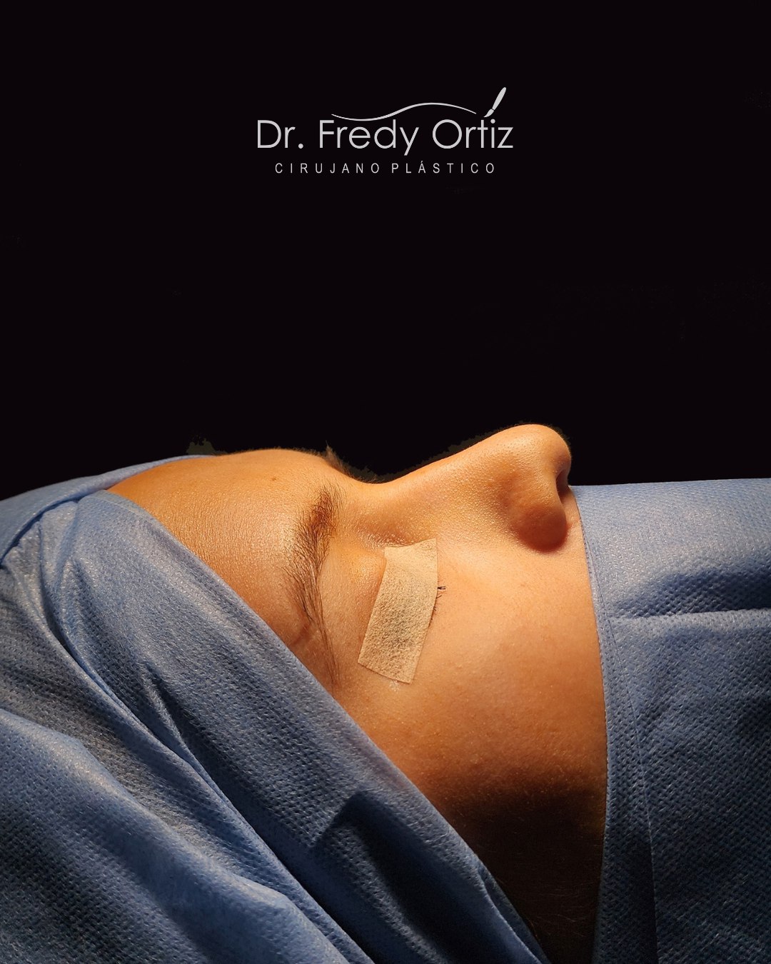 Ảnh trước và sau