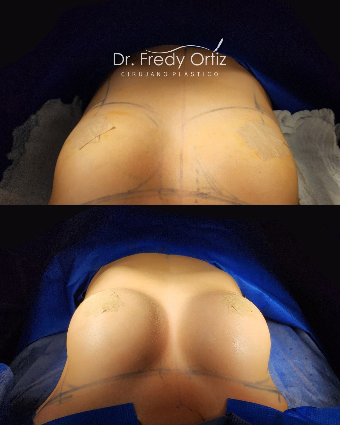 Ảnh trước và sau