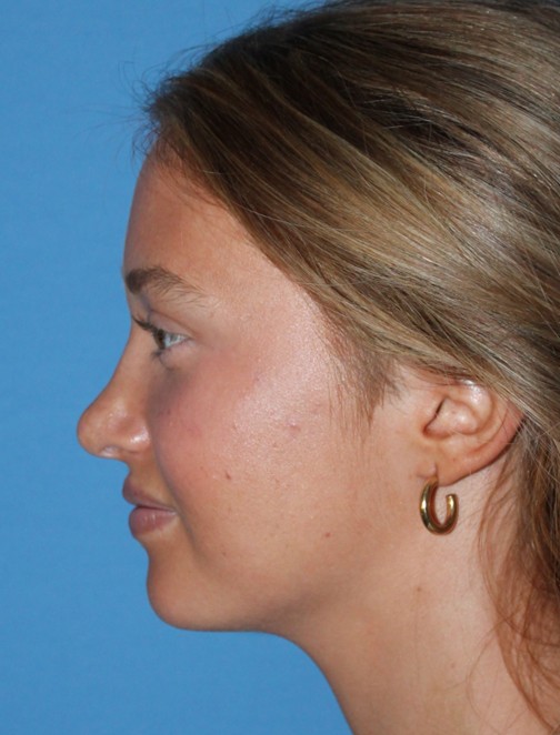 Vorher-Nachher-Bilder