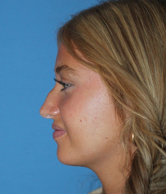 Vorher-Nachher-Bilder