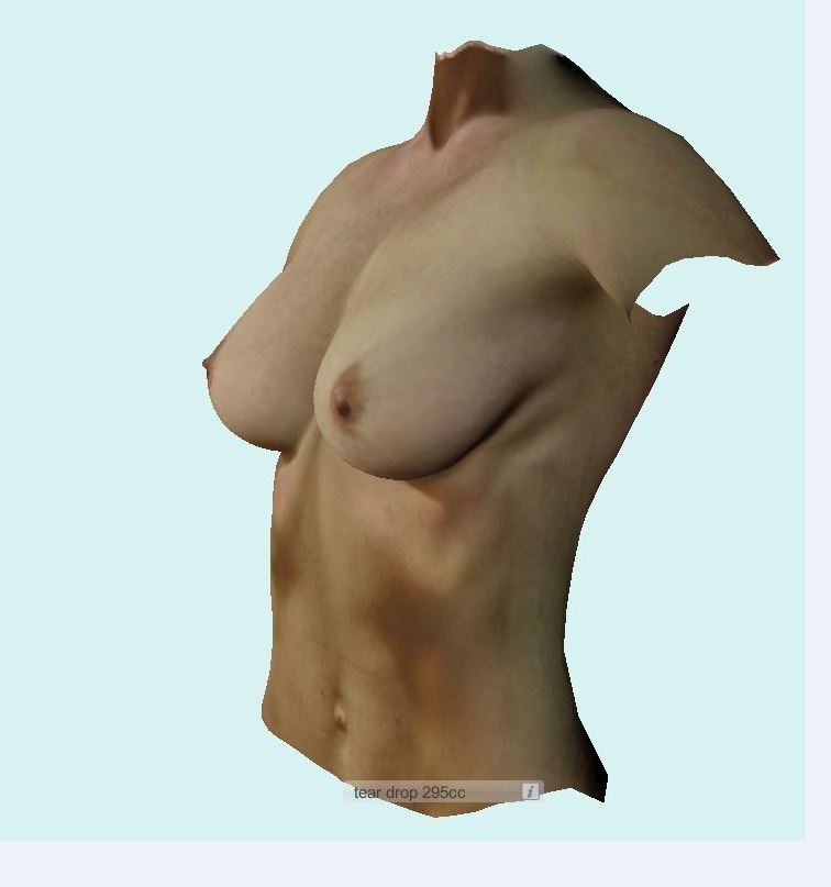 Vorher-Nachher-Bilder