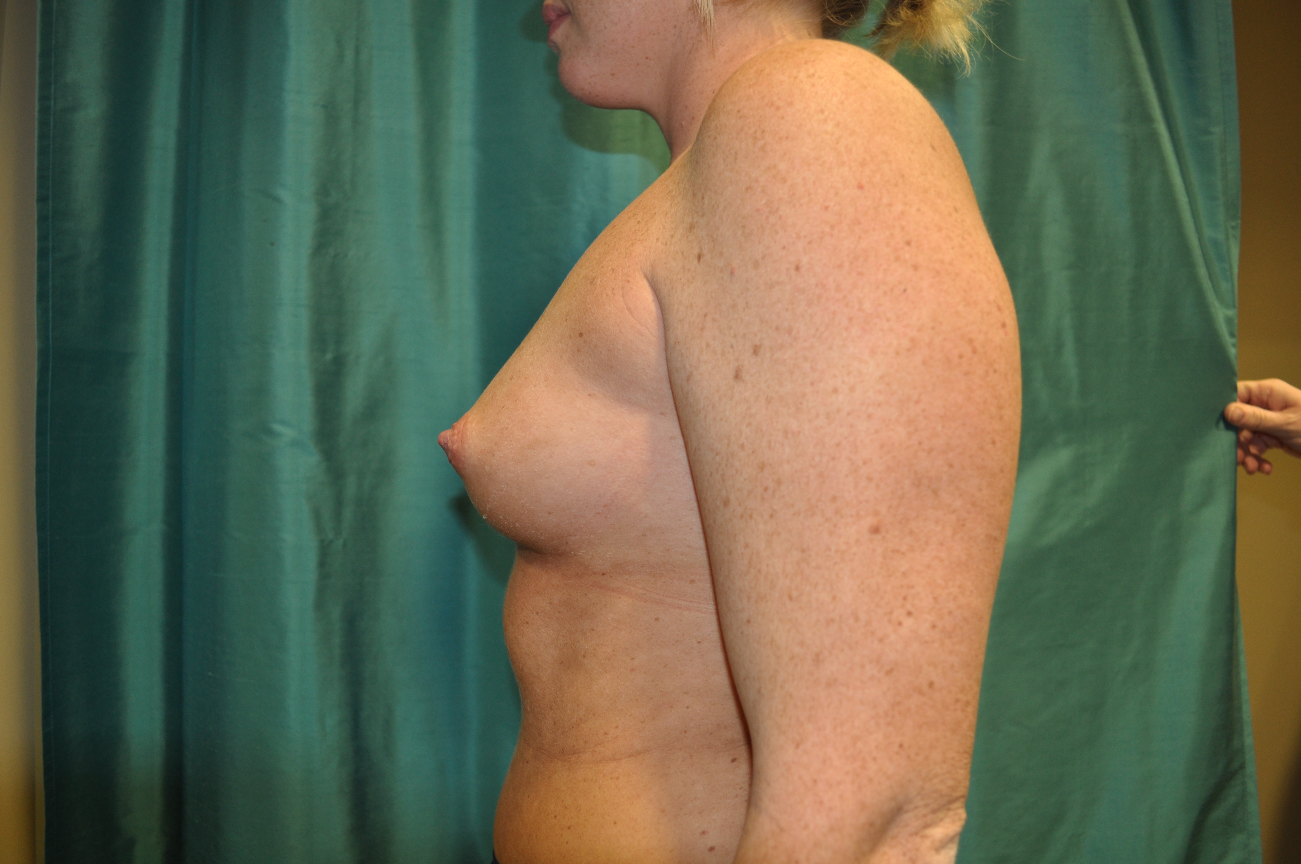 Vorher-Nachher-Bilder