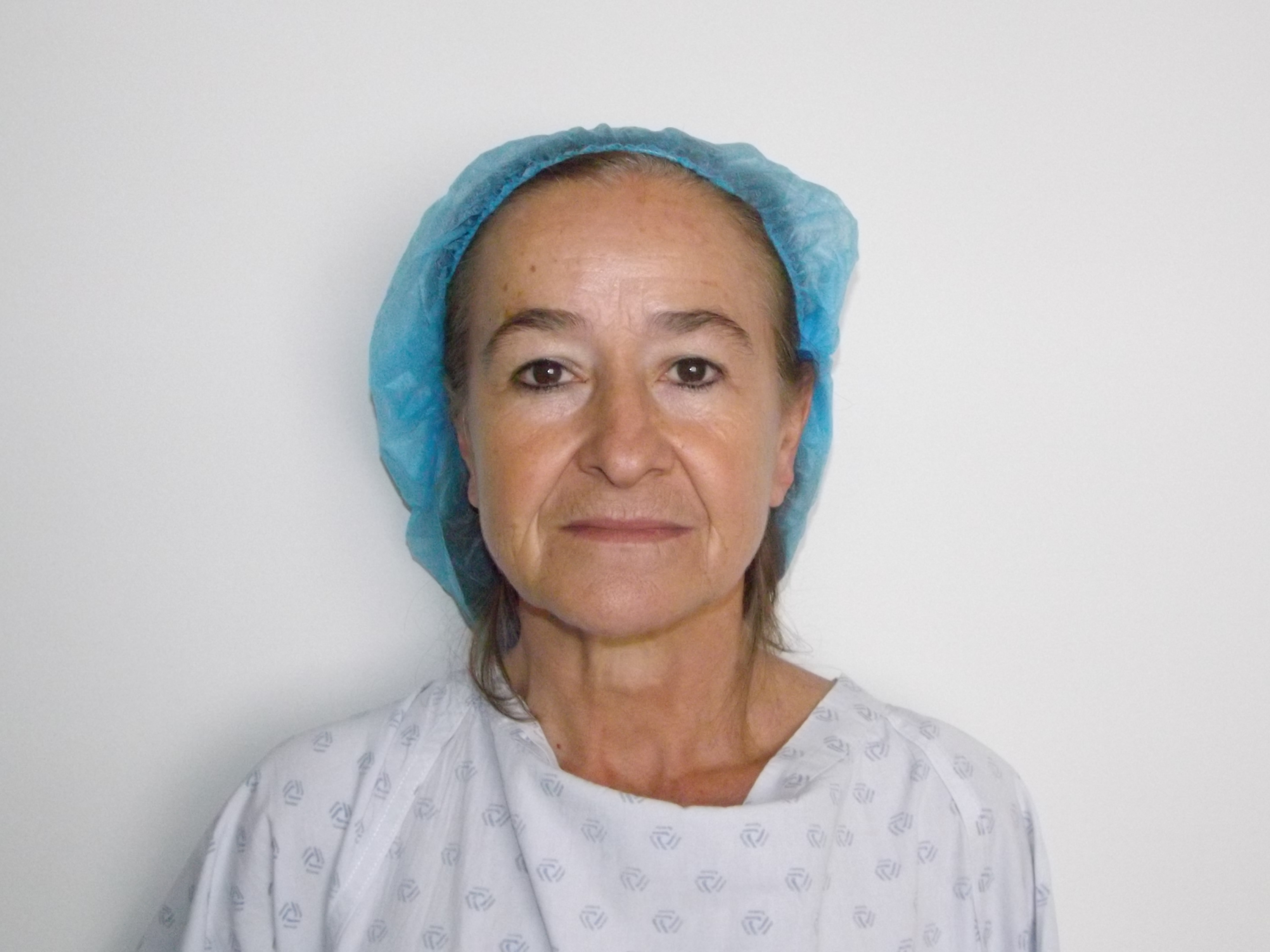 Photos avant et après