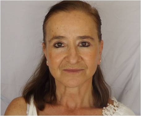 Photos avant et après