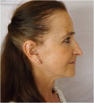 Photos avant et après